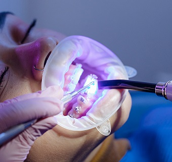 ortodoncia dentista Pontevedra