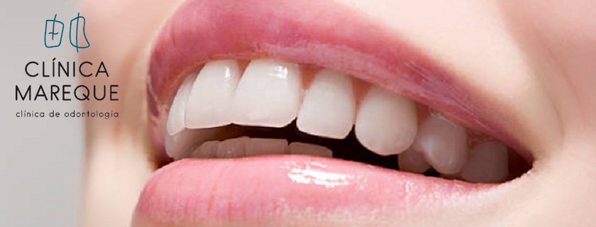 dientes dentista Pontevedra Marisol Mareque