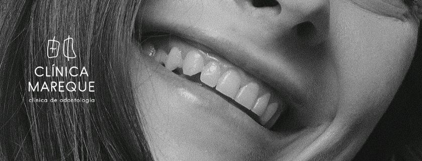 Implantología en Pontevedra