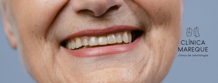 Periodoncia en Pontevedra