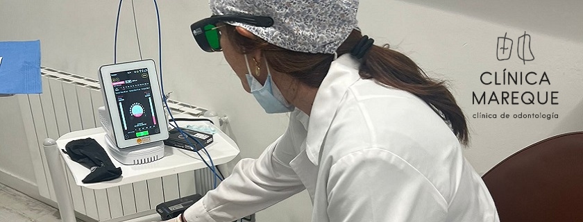 Ventajas del láser odontológico dentista en Pontevedra