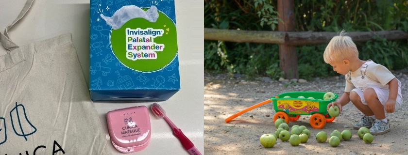 Ortodoncia infantil Invisalign Palatal Expander