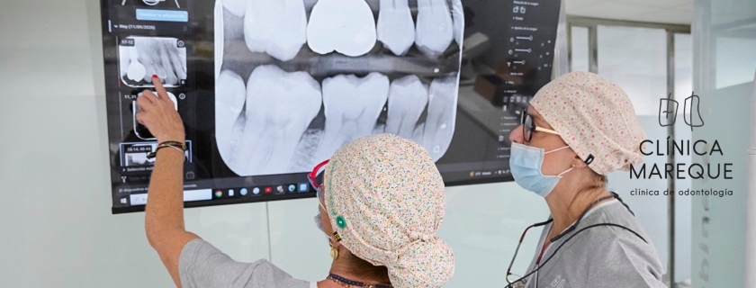 Implantes en Pontevedra